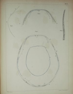 Los 329 - Welcker, Hermann - Untersuchungen über Wachsthum und Bau des menschlichen Schädels. Leipzig, Engelmann, 1862 - 7 - thumb