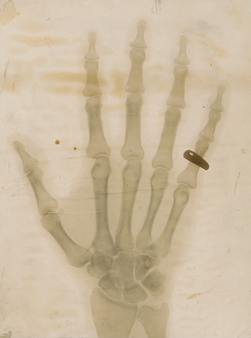 Lot 4247, Auction 126, X-ray Photography, X-ray of a hand with a ring